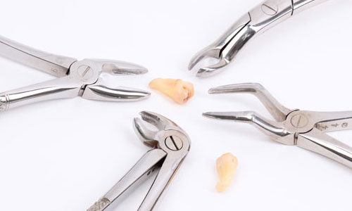 Удаление зубов инструменты