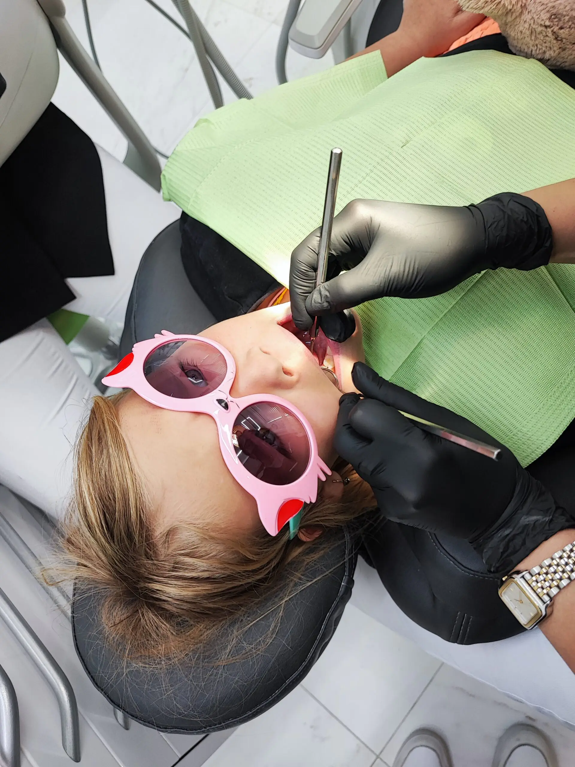 Лечение кариеса у детей